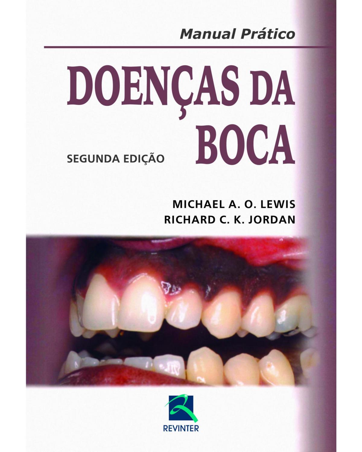 Doenças da boca - manual prático - 2ª Edição | 2014