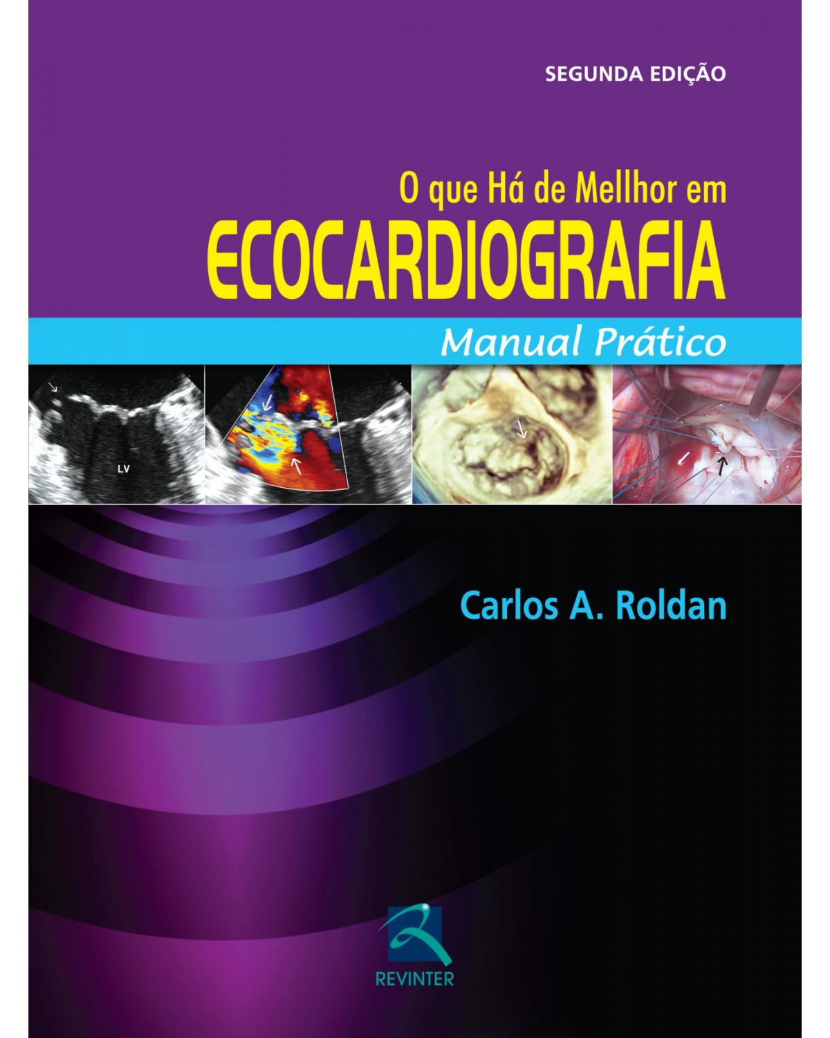 O que há de melhor em ecocardiografia - manual prático - 2ª Edição | 2014