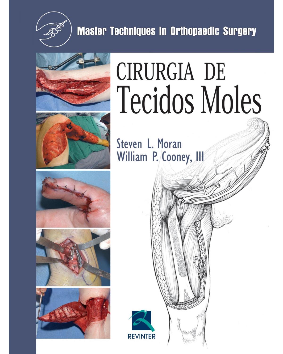 Cirurgia de tecidos moles - 1ª Edição | 2014