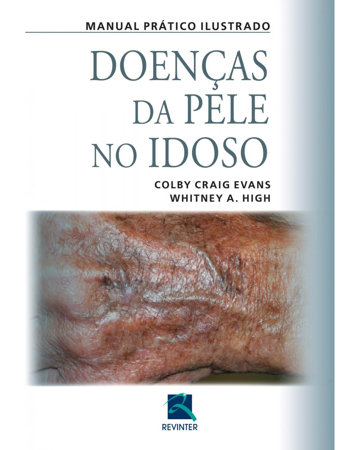 Doenças da pele no idoso: manual prático ilustrado - 1ª Edição | 2015