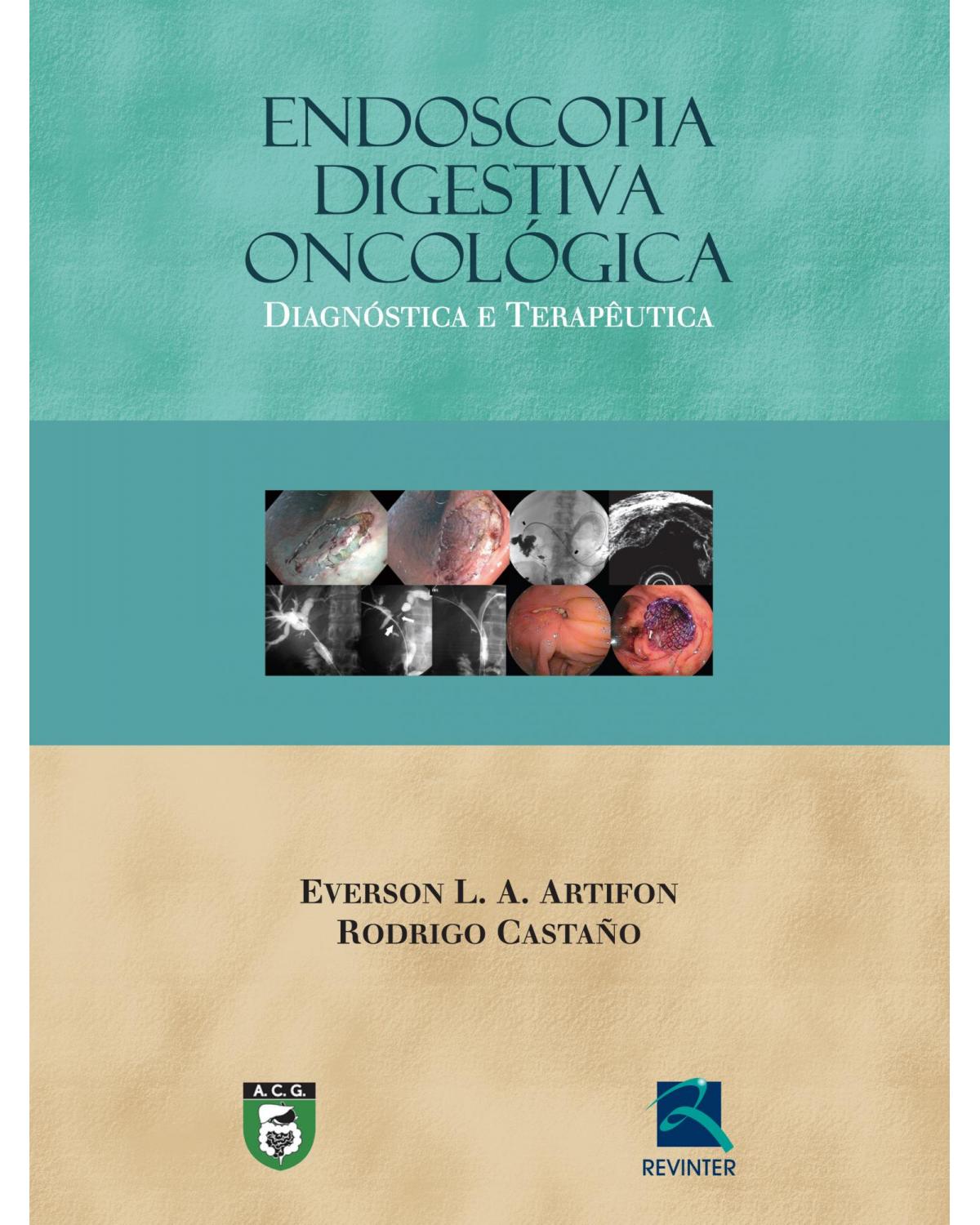 Endoscopia digestiva oncológica - diagnóstica e terapêutica - 1ª Edição | 2015
