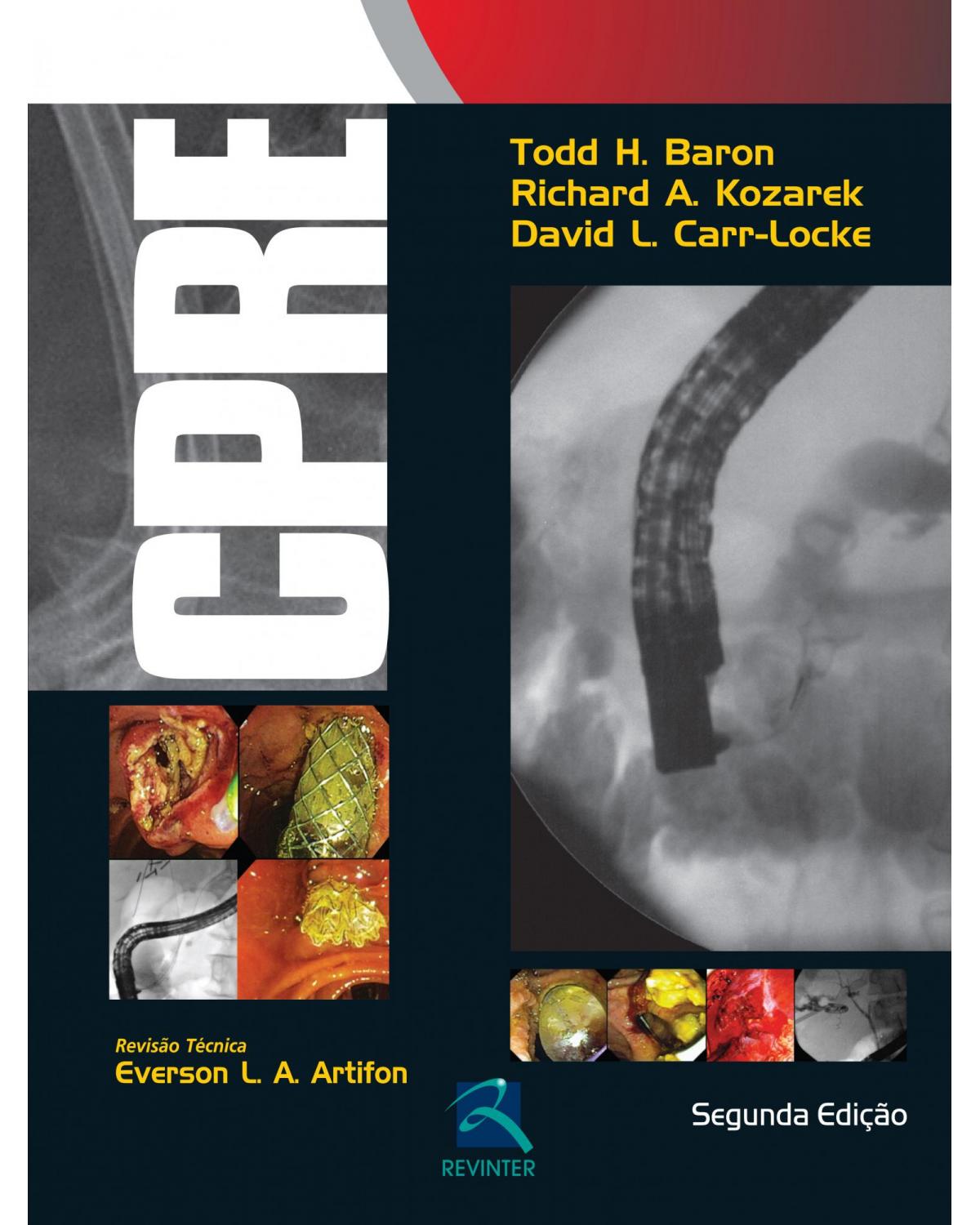 CPRE - colangiopancreatografia retrograda endoscópica - 2ª Edição | 2015