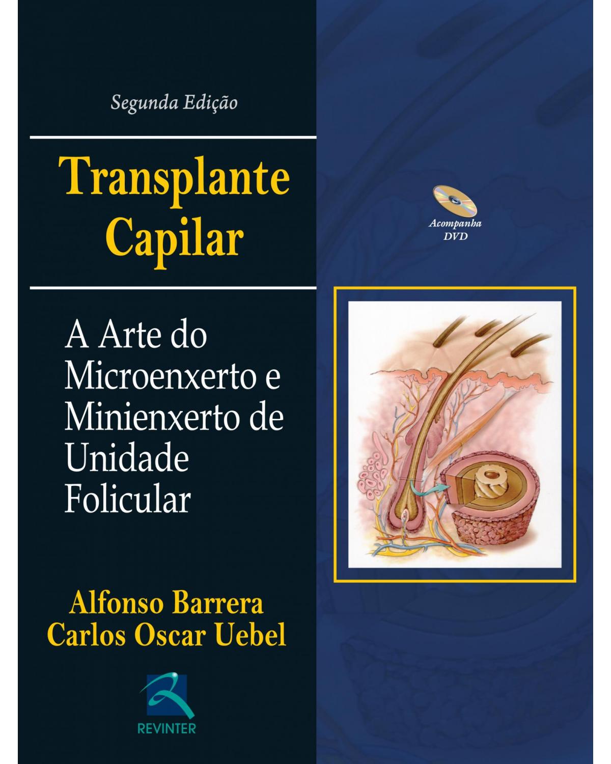 Transplante capilar - a arte do microenxerto e minienxerto de unidade folicular - 2ª Edição | 2015