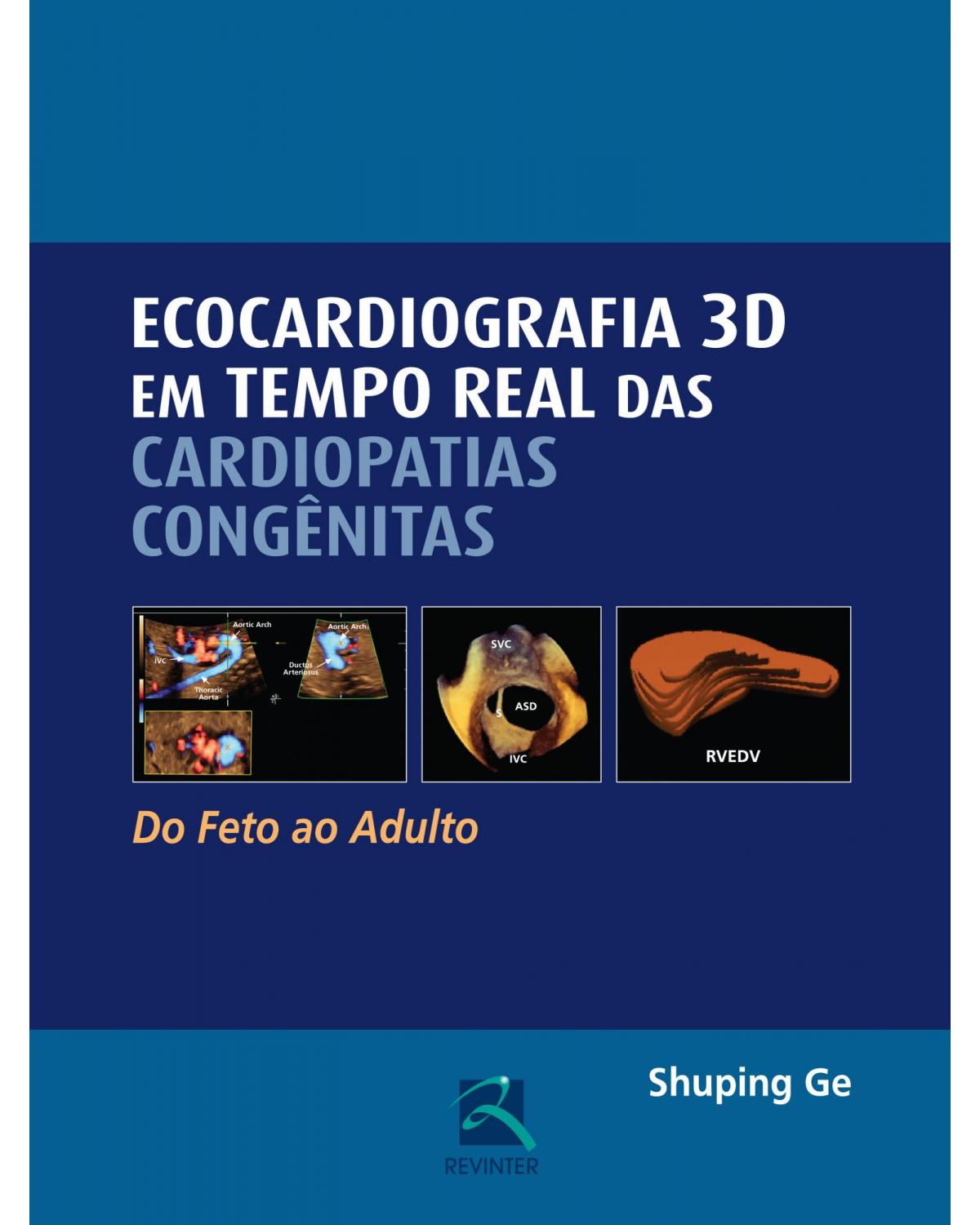 Ecocardiografia 3D em tempo real das cardiopatias congênitas - do feto ao adulto - 1ª Edição | 2016