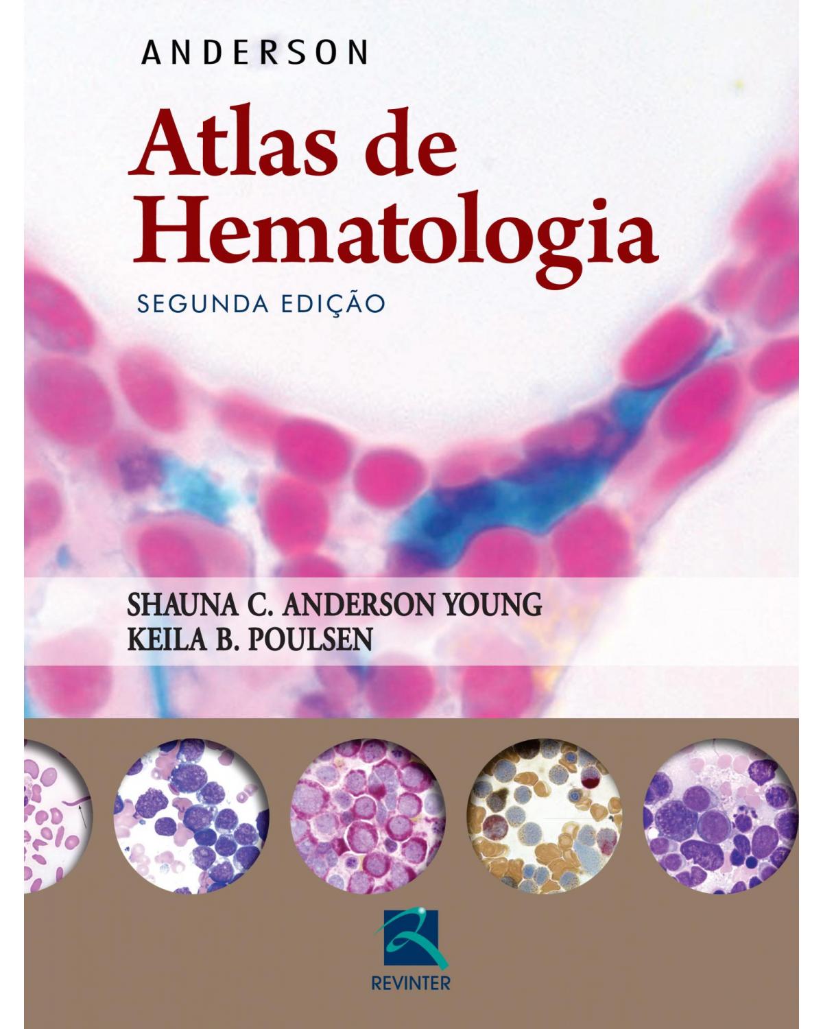 Anderson: Atlas de hematologia - 2ª Edição | 2016