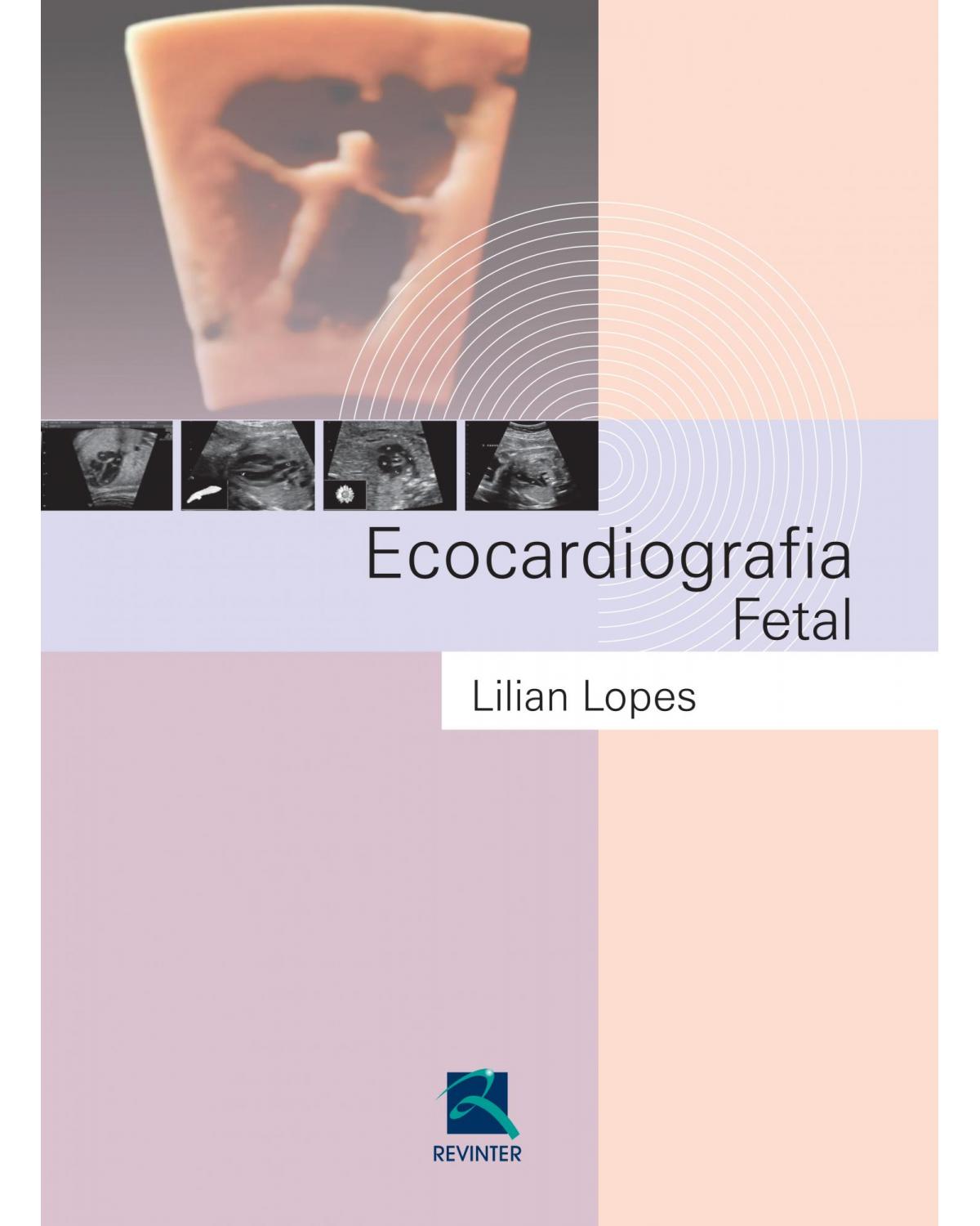 Ecocardiografia fetal - 1ª Edição | 2016