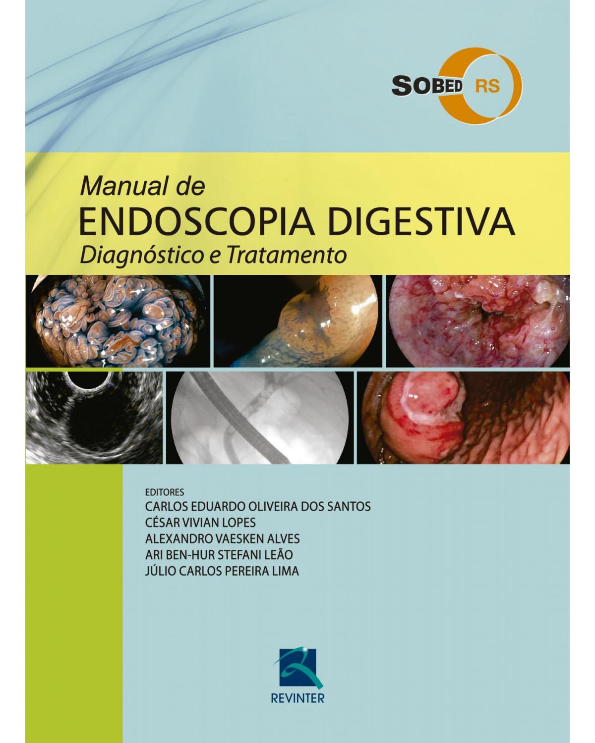 Manual de Endoscopia Digestiva - Diagnóstico e Tratamento - 1ª Edição | 2016
