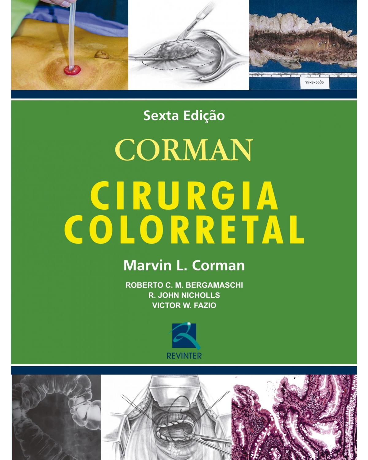 Cirurgia Colorretal - 6ª Edição | 2017
