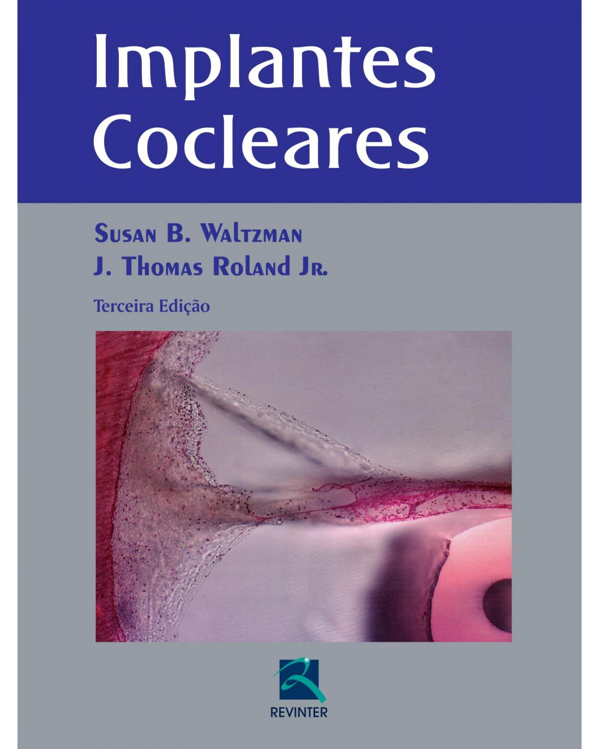 Implantes Cocleares - 3ª Edição | 2016