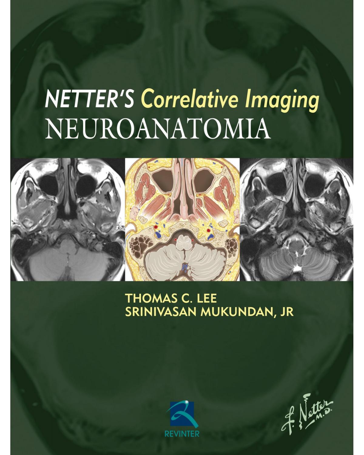 Netter's Correlative Imaging - Neuroanatomia - 1ª Edição | 2016