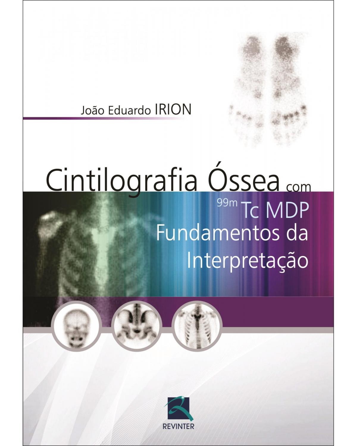 Cintilografia Óssea com 99m Tc MDP - Fundamentos da Interpretação - 1ª Edição | 2016