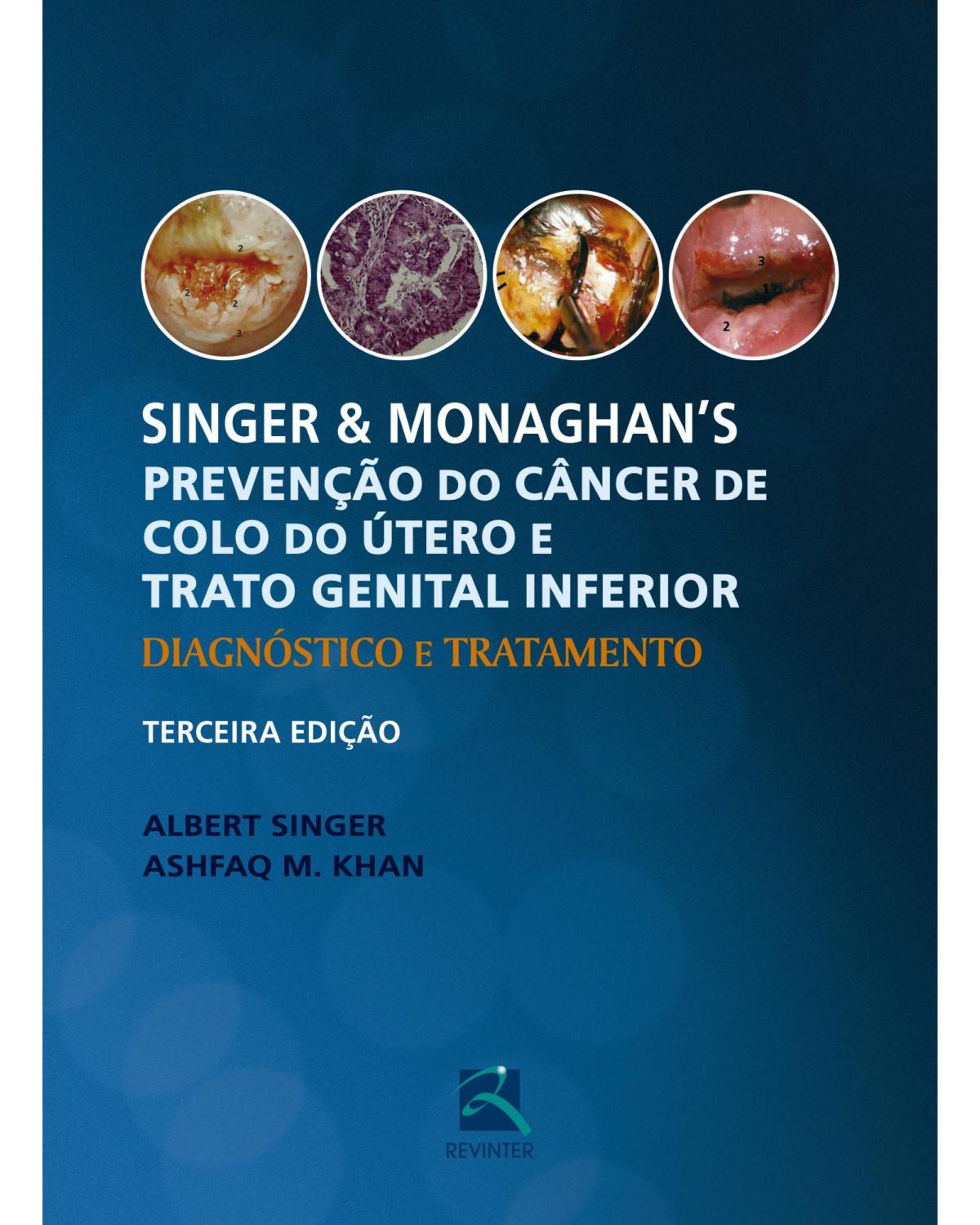 Singer e Monaghan's - Prevenção do Câncer de Colo do Útero e Trato Genital Inferior - Diagnóstico e Tratamento - 3ª Edição | 2017