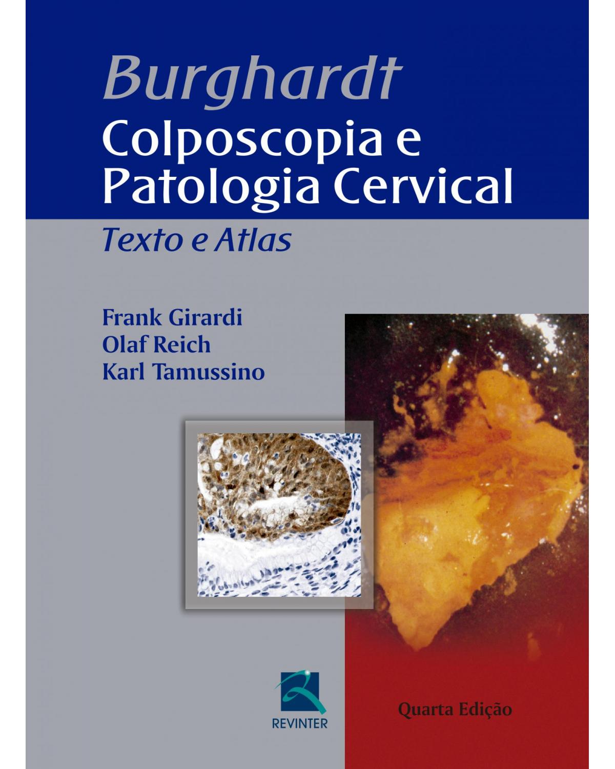 Burghardt - Colposcopia e Patologia Cervical - Texto e Atlas - 4ª Edição | 2017