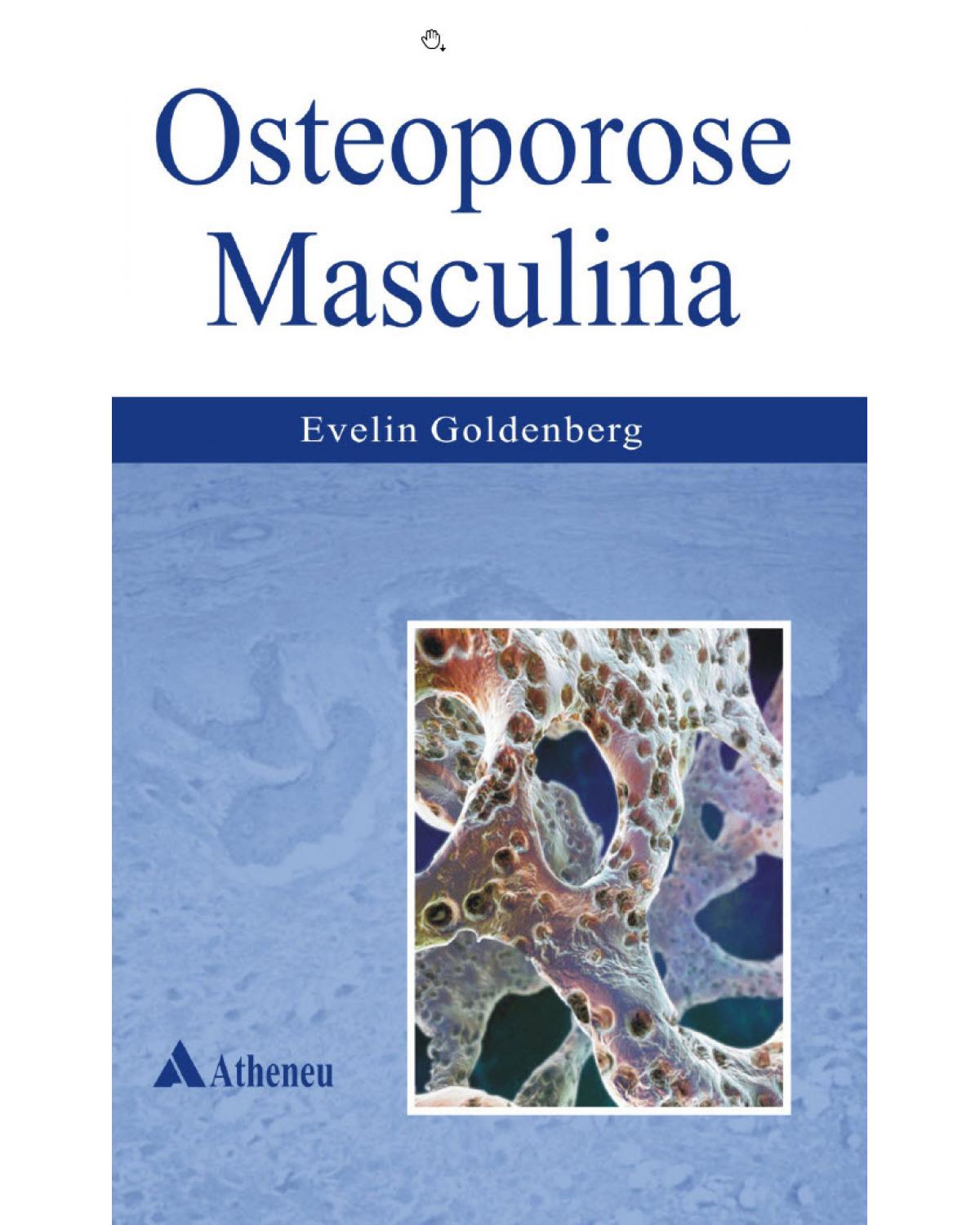 Osteoporose masculina - 1ª Edição | 2009