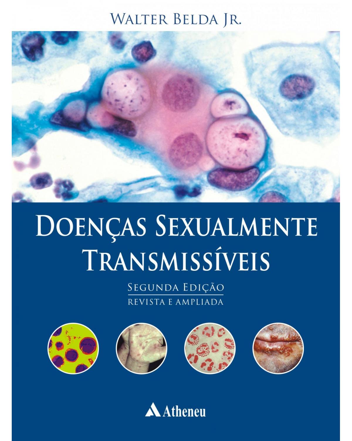 Doenças sexualmente transmissíveis - 2ª Edição | 2009