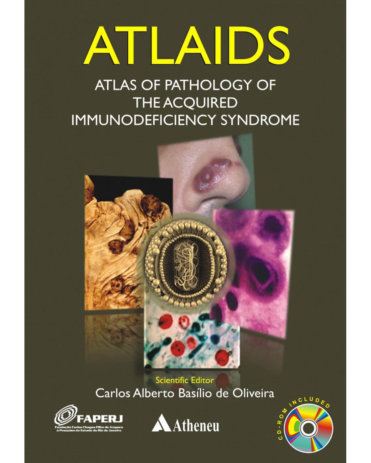 ATLAIDS: Atlas of pathology of the acquired immunodeficiency syndrome - 1ª Edição | 2010