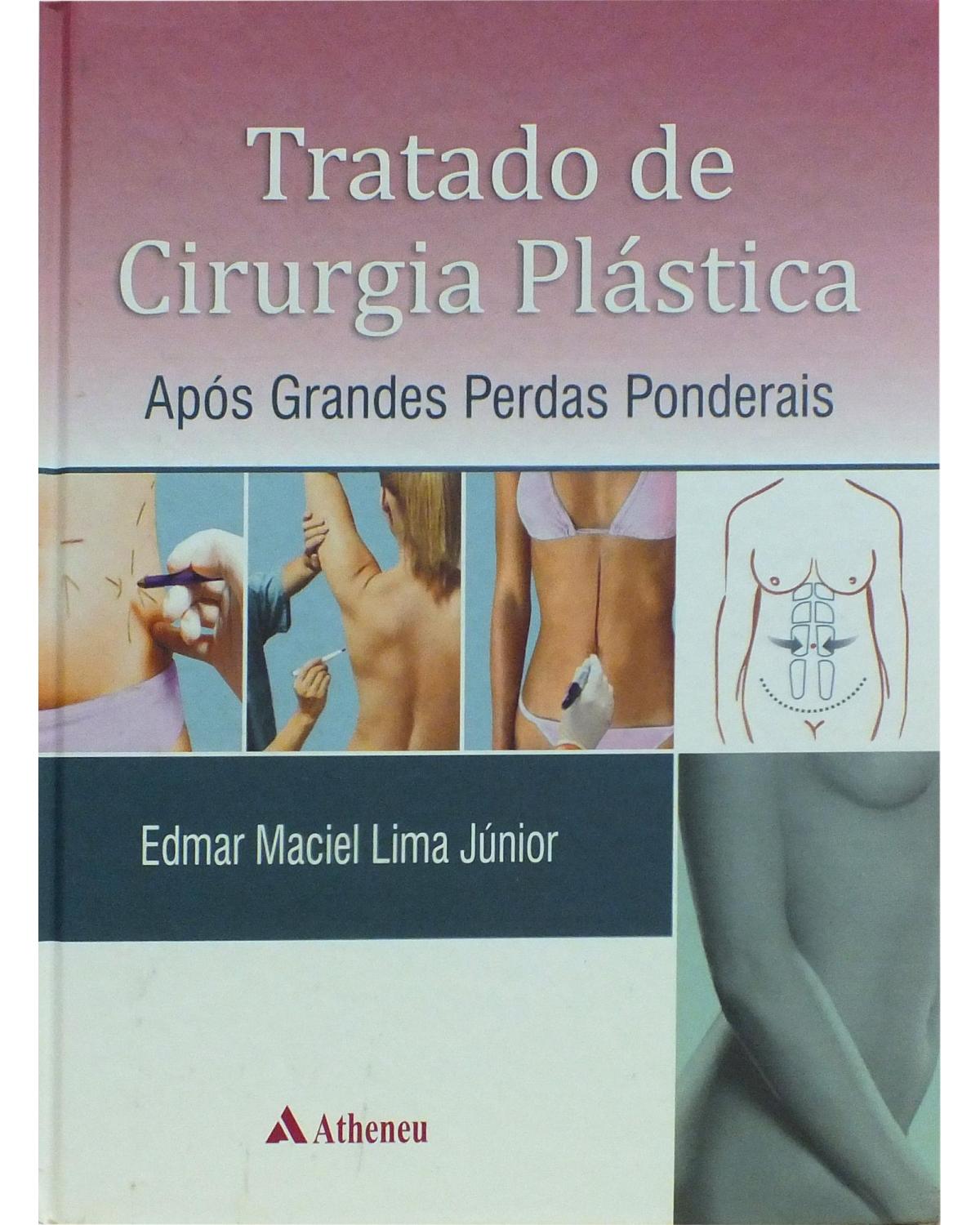 Tratado de cirurgia plástica após grandes perdas ponderais - 1ª Edição | 2010