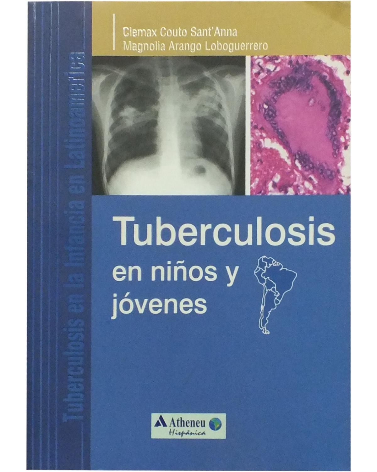 Tuberculosis en niños y jóvenes - 1ª Edição | 2011