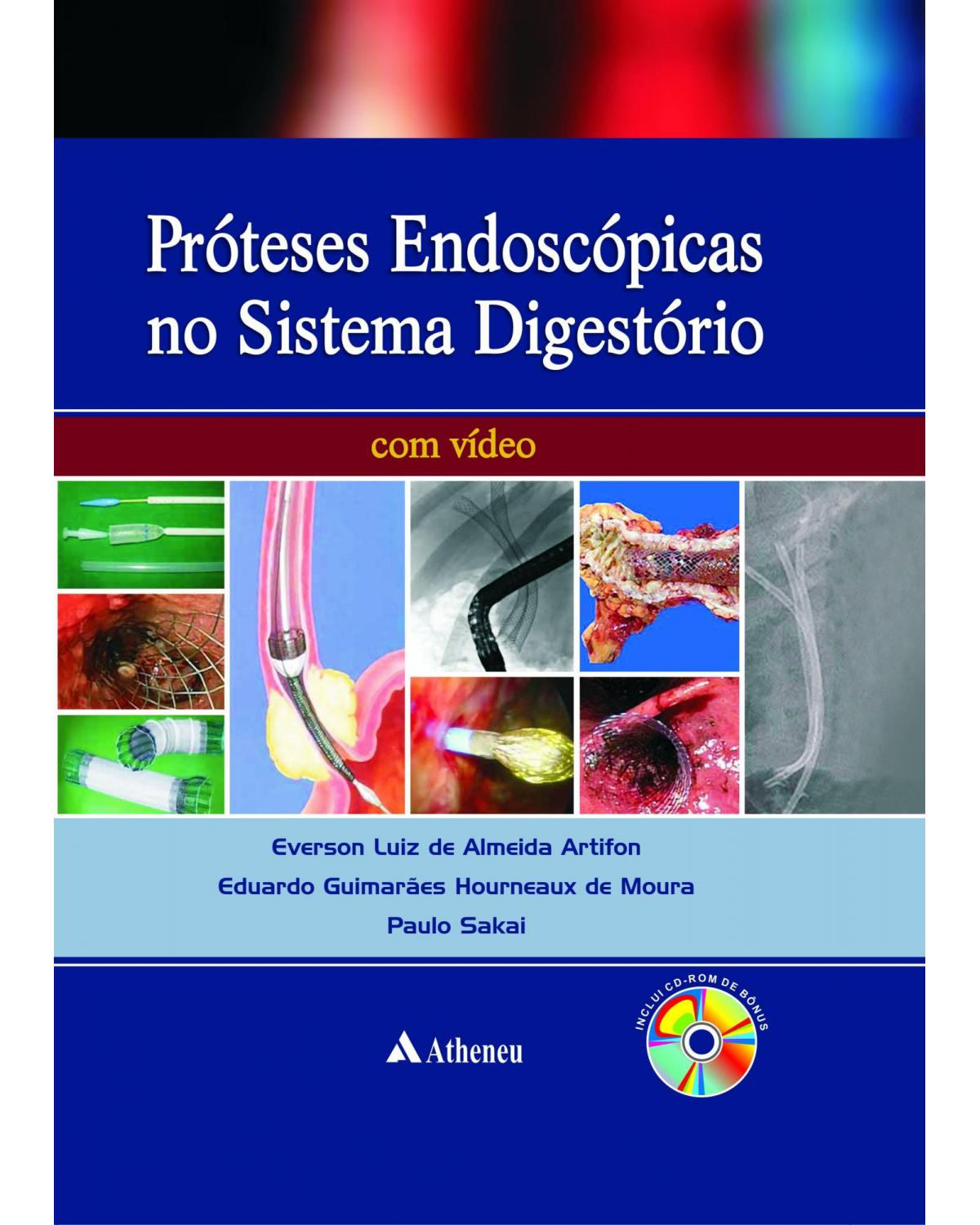 Próteses endoscópicas do aparelho digestório - 1ª Edição | 2012