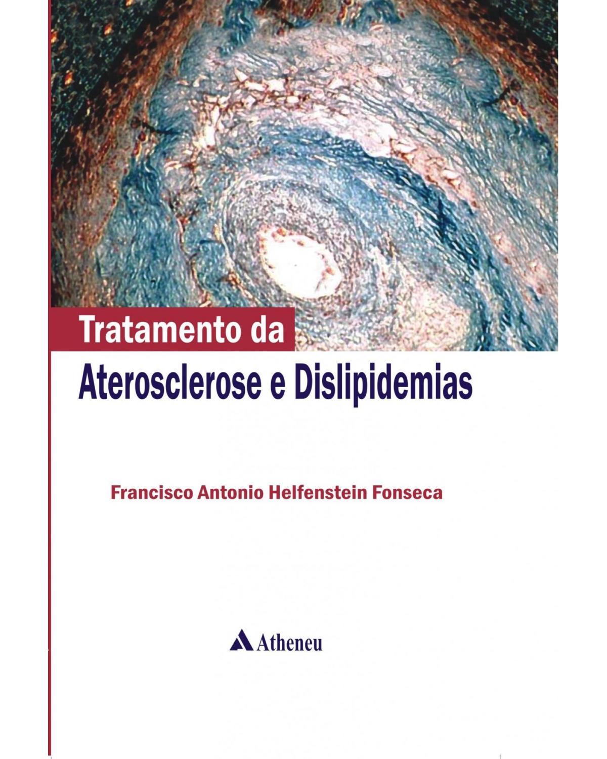 Tratamento da aterosclerose e dislipidemias - 1ª Edição | 2012
