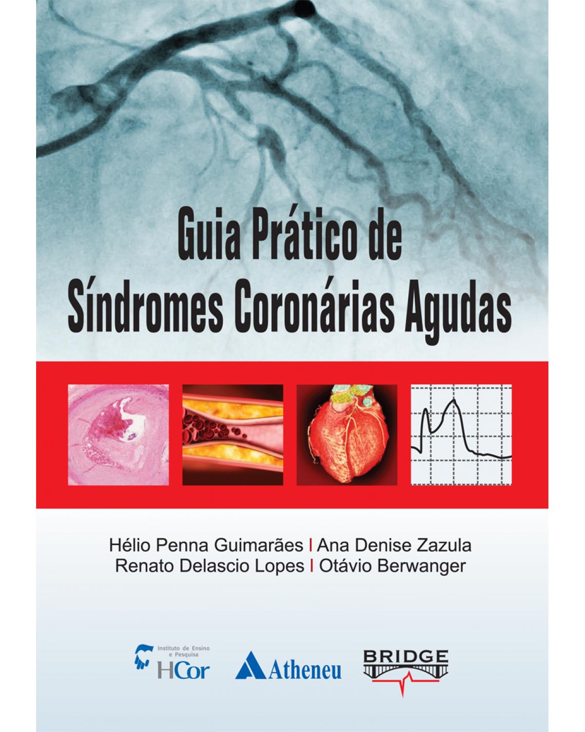 Guia prático de síndromes coronárias agudas - 1ª Edição | 2013