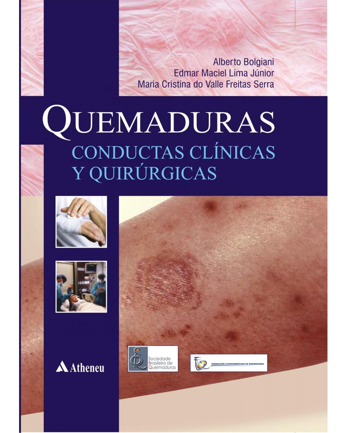 Quemaduras - Conductas clínicas y quirúrgicas - 1ª Edição | 2013