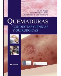 Quemaduras - Conductas clínicas y quirúrgicas - 1ª Edição | 2013