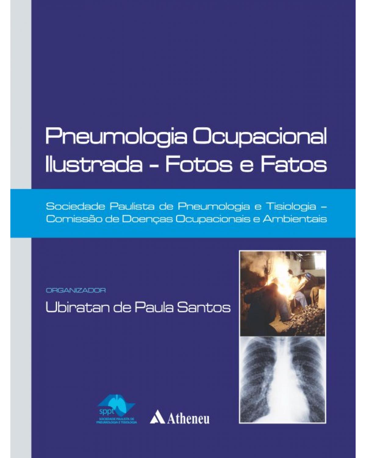 Pneumologia ocupacional ilustrada - fotos e fatos - 1ª Edição | 2013