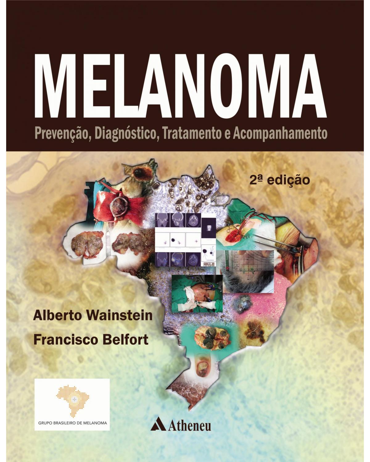 Melanoma - prevenção, diagnóstico, tratamento e acompanhamento - 2ª Edição | 2014