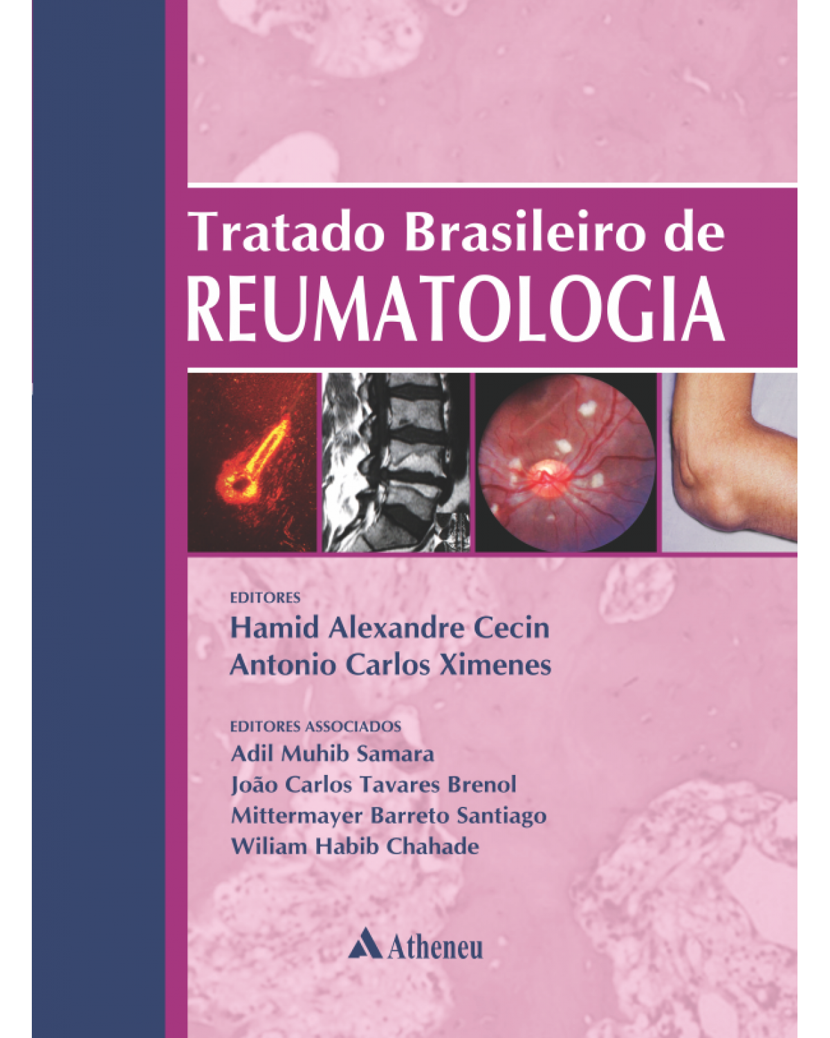 Tratado brasileiro de reumatologia - 1ª Edição | 2015