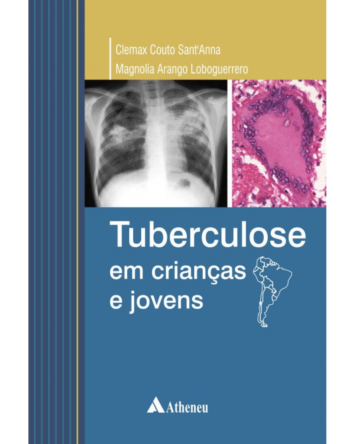 Tuberculose em criancas e jovens - 1ª Edição | 2014