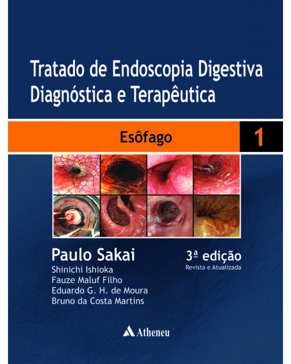 Tratado de endoscopia digestiva diagnóstica e terapêutica - Volume 1: esôfago - 3ª Edição | 2014