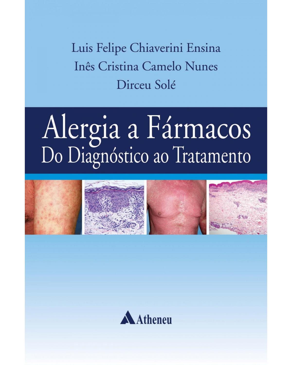 Alergia a fármacos do diagnóstico ao tratamento - 1ª Edição | 2018