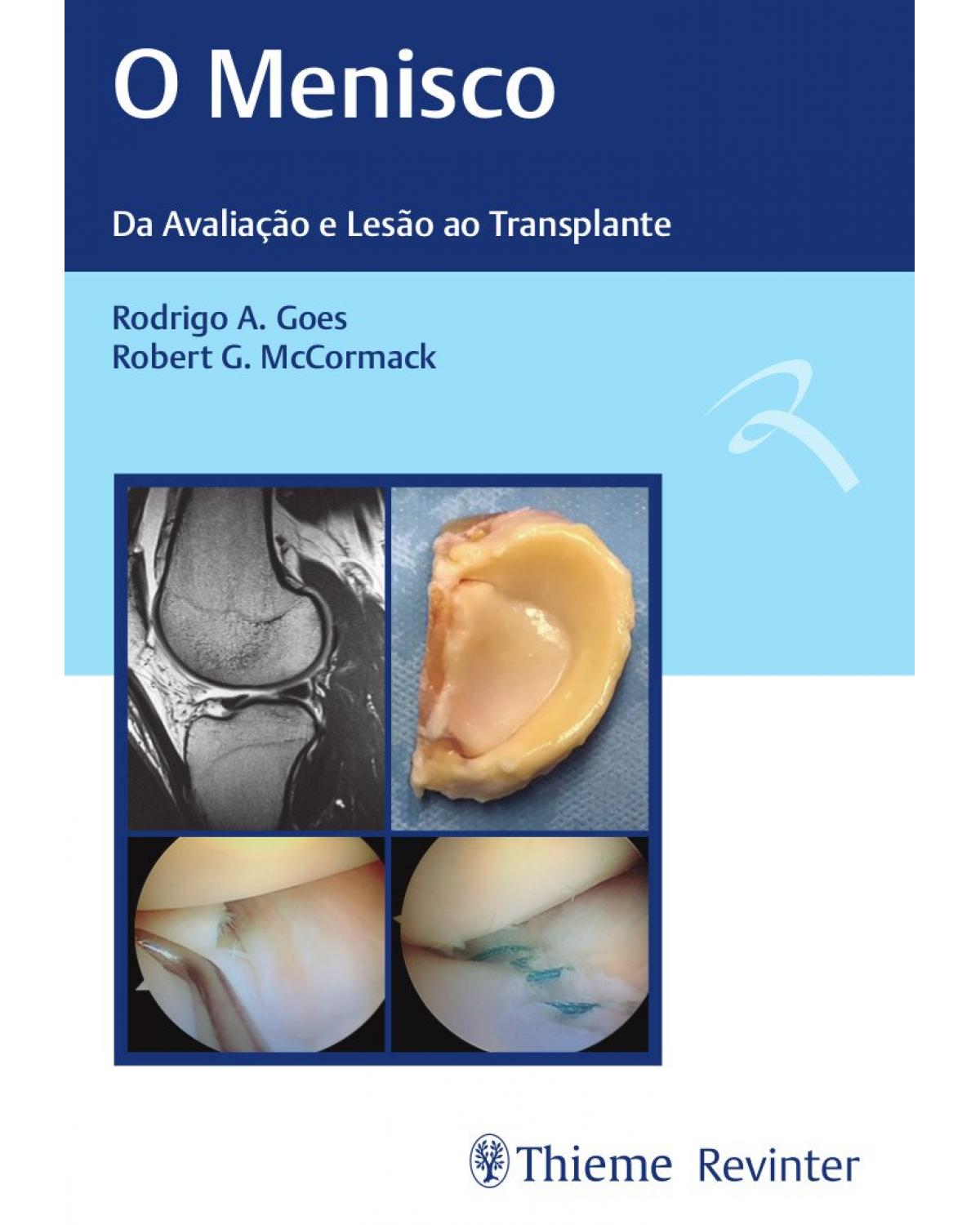 O menisco - da avaliação e lesão ao transplante - 1ª Edição | 2019