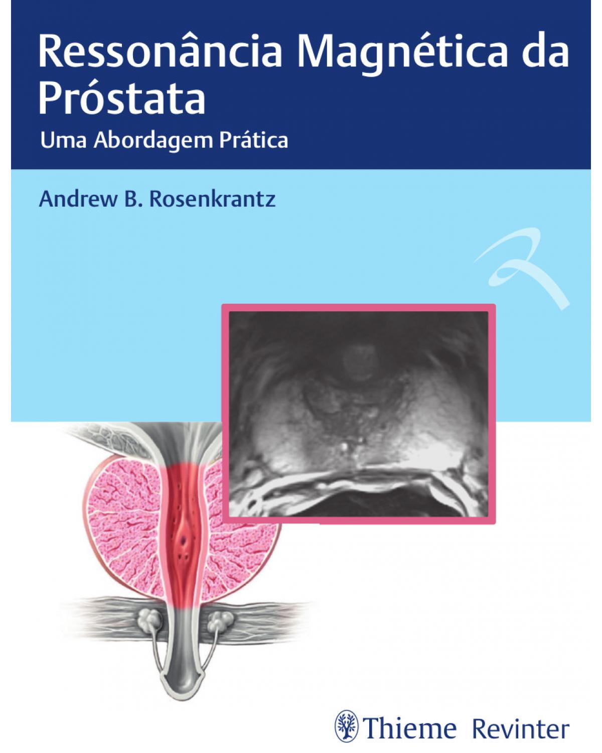 Ressonância magnética da próstata - uma abordagem prática - 1ª Edição | 2018