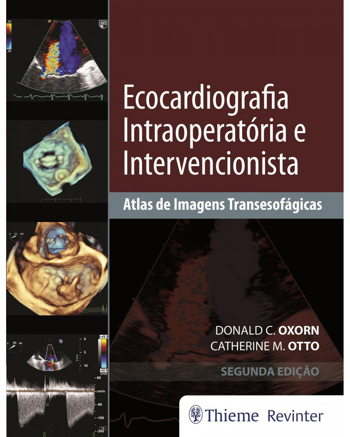 Ecocardiografia intraoperatória e intervencionista - atlas de imagens transesofágicas - 2ª Edição | 2018