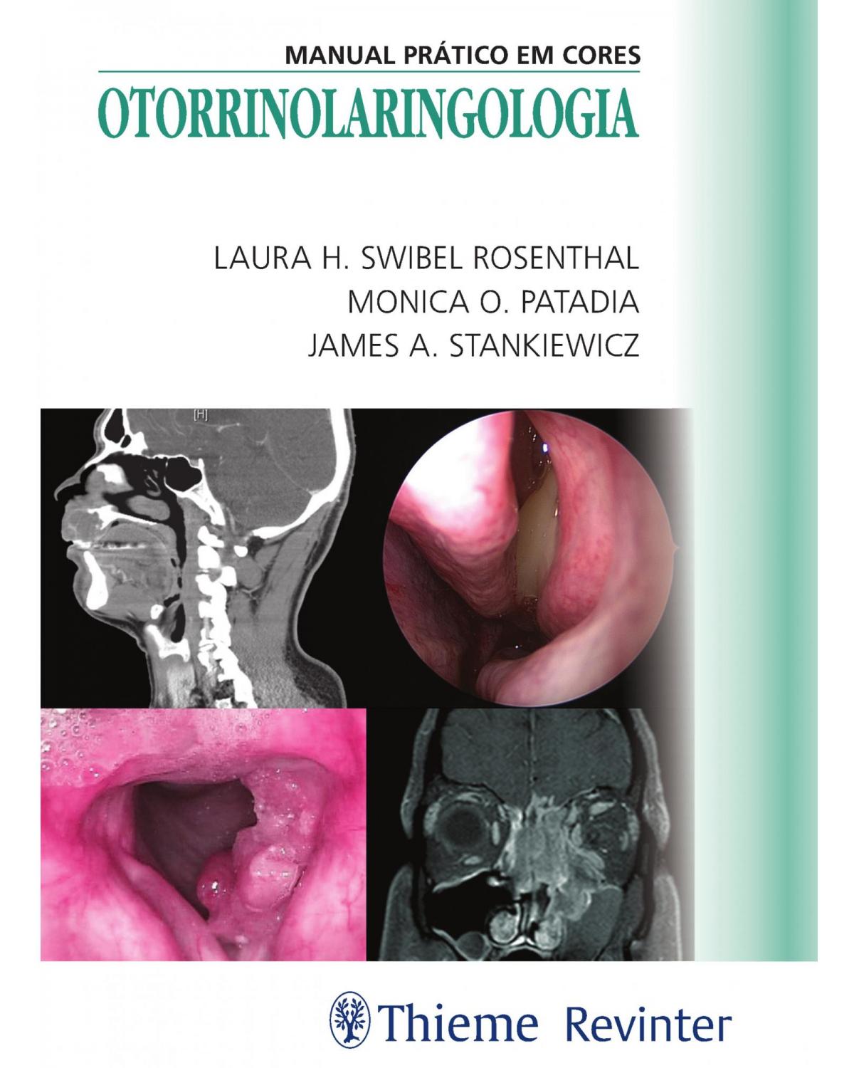 Otorrinolaringologia - manual prático em cores - 1ª Edição | 2018