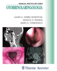 Otorrinolaringologia - manual prático em cores - 1ª Edição | 2018