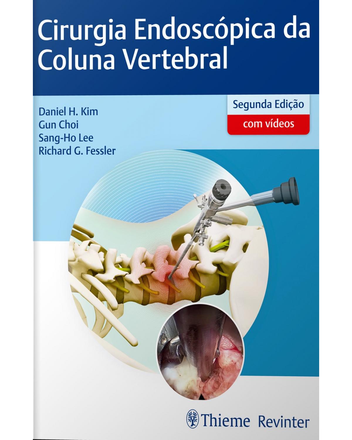 Cirurgia endoscópica da coluna vertebral - 2ª Edição | 2019