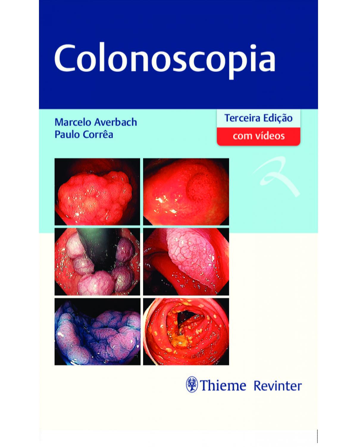Colonoscopia - 3ª Edição | 2020
