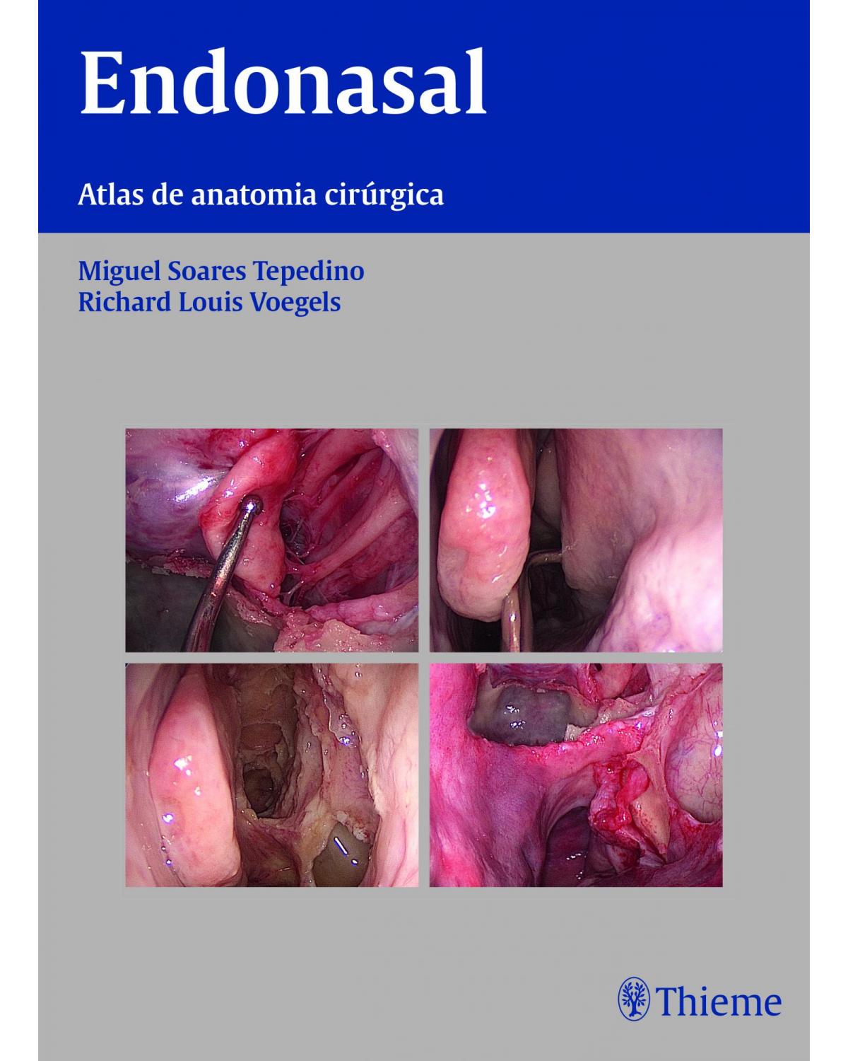 Endonasal - atlas de anatomia cirúrgica - 1ª Edição | 2014