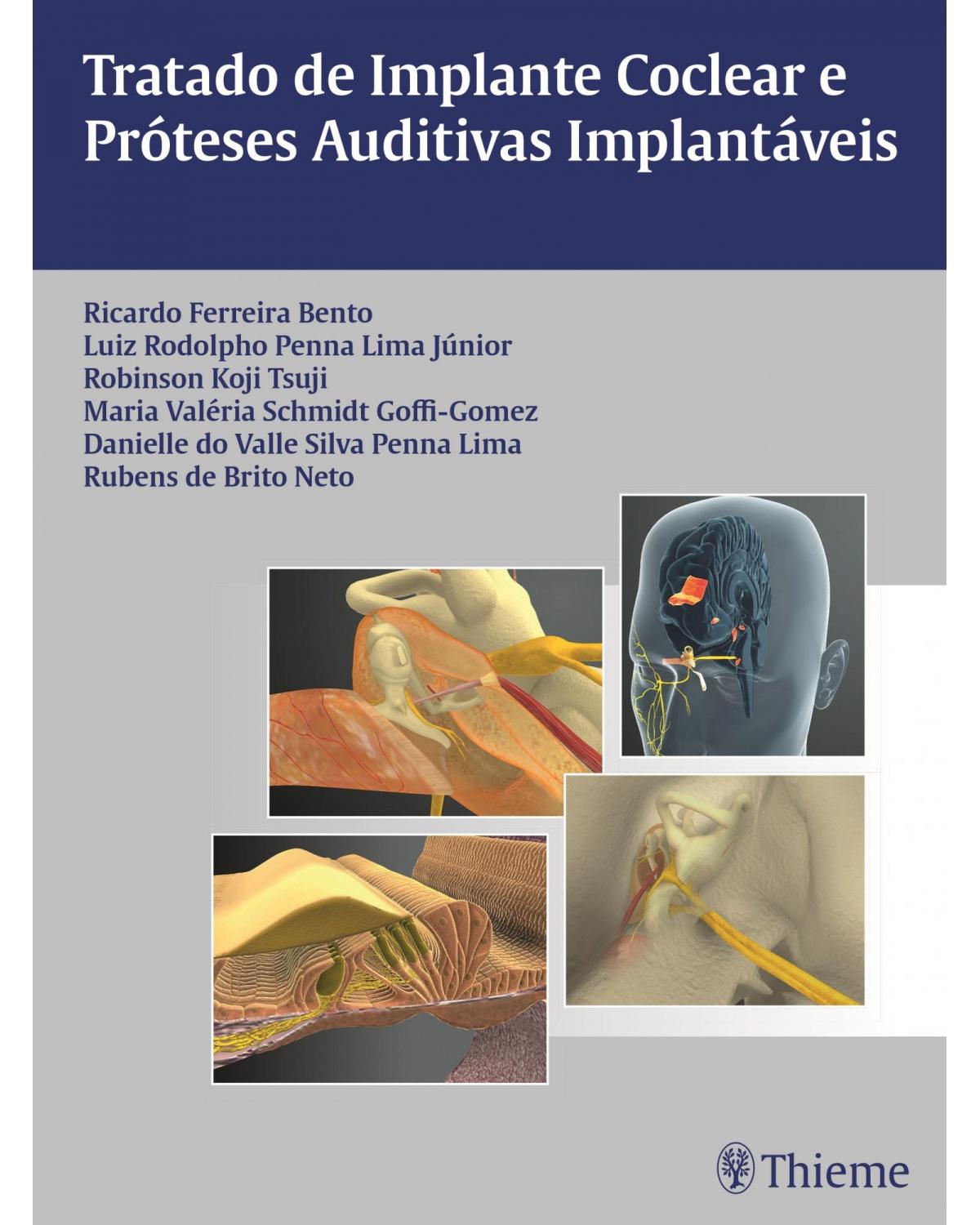 Tratado de implante coclear e próteses auditivas implantáveis - 1ª Edição | 2014