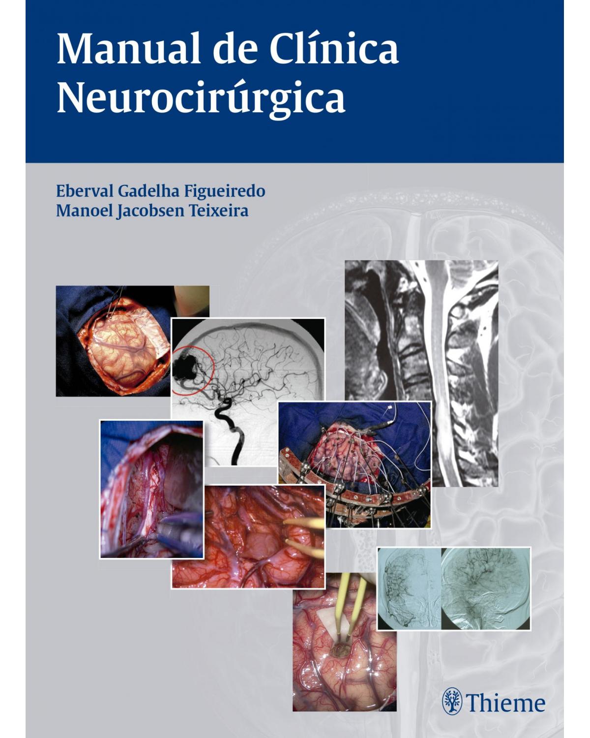 Manual de clínica neurocirúrgica - 1ª Edição | 2016