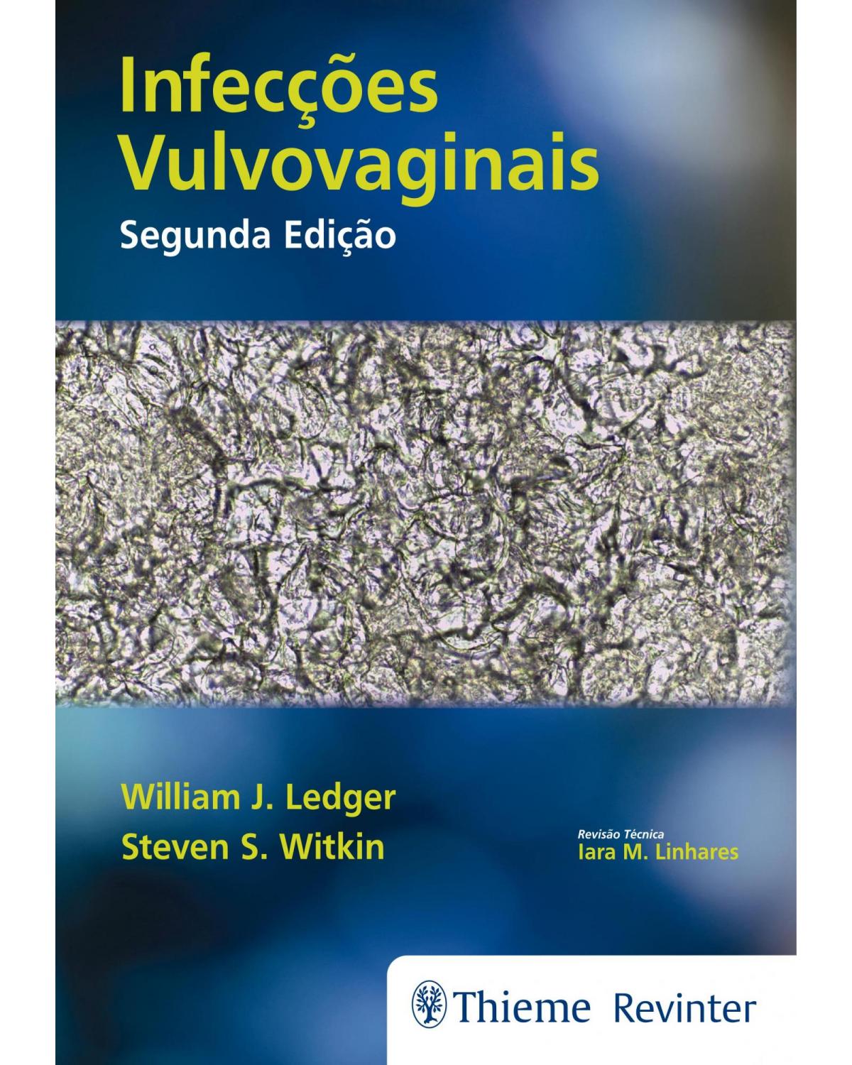 Infecções Vulvovaginais - 2ª Edição | 2017