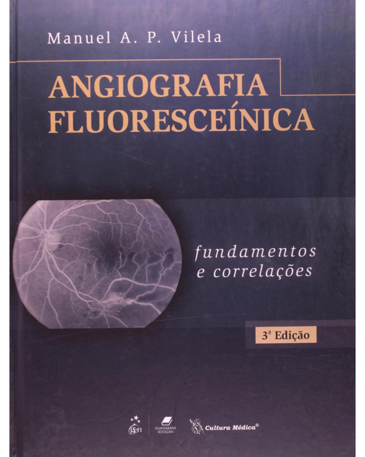 Angiografia fluoresceínica: Fundamentos e correlações - 3ª Edição | 2011