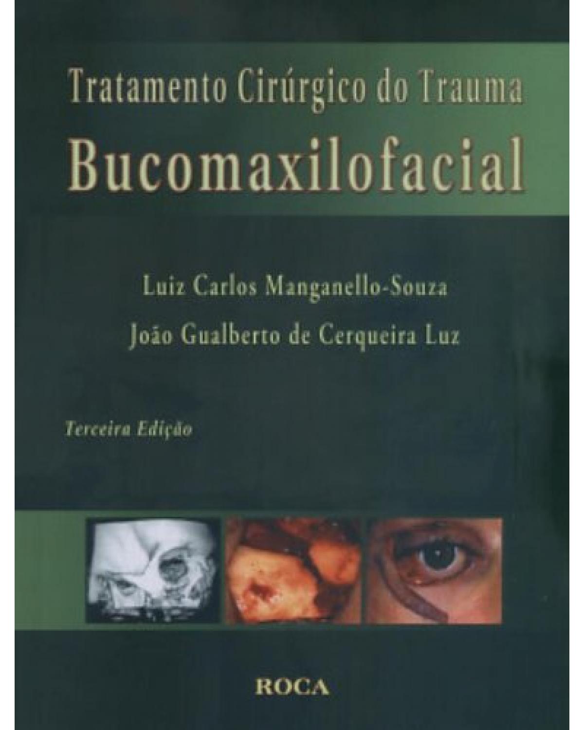 Tratamento cirúrgico do trauma bucomaxilofacial - 3ª Edição | 2006