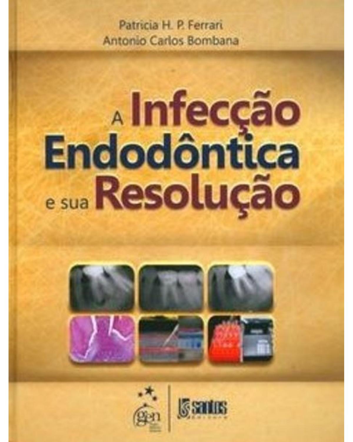 A infecção endodôntica e sua resolução - 1ª Edição | 2010
