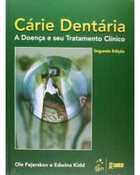 Cárie dentária - A doença e seu tratamento clínico - 2ª Edição | 2011