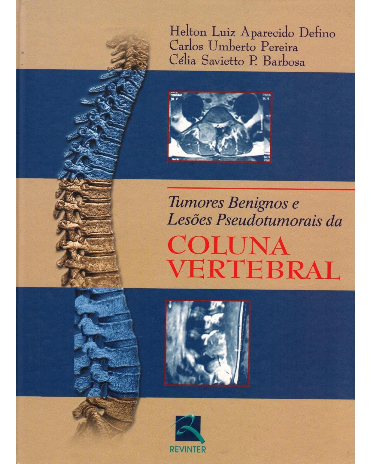 Tumores benignos e lesões pseudotumorais da coluna vertebral - 1ª Edição | 2002