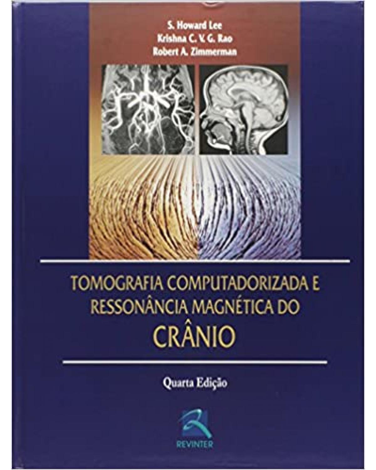 Tomografia computadorizada e ressonância magnética do crânio - 4ª Edição | 2003